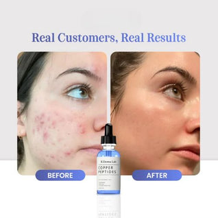 GHK-Cu Copper Peptide Serum