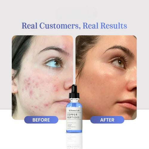 GHK-Cu Copper Peptide Serum