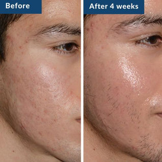 GHK-Cu Copper Peptide Serum