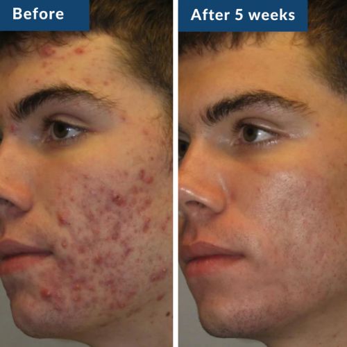 GHK-Cu Copper Peptide Serum